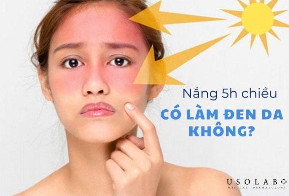 nắng 5h chiều có làm đen da không