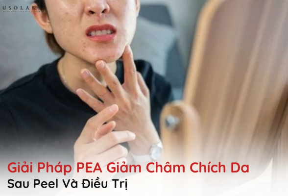 pea giảm châm chích
