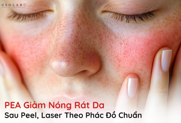 pea giảm nóng rát