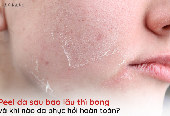 peel da sau bao lâu thì bong