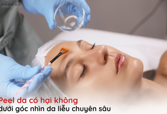 peel da có hại không