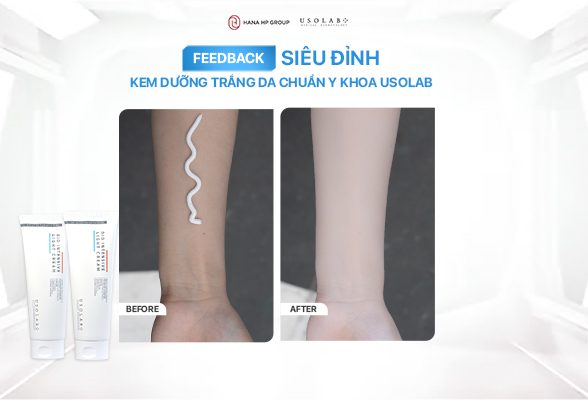 phản hồi khách hàng