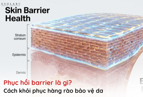 phục hồi barrier là gì