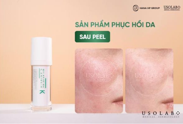 Top 10 Sản phẩm phục hồi da sau peel tốt nhất? Cách chọn theo từng loại da