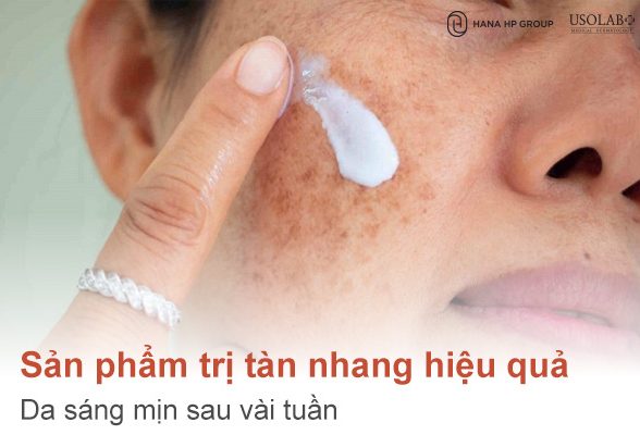 Top 4 sản phẩm trị tàn nhang hiệu quả – Da sáng mịn sau vài tuần
