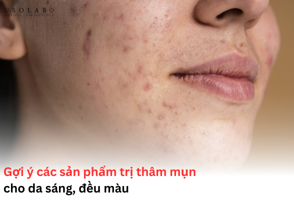sản phẩm trị thâm mụn