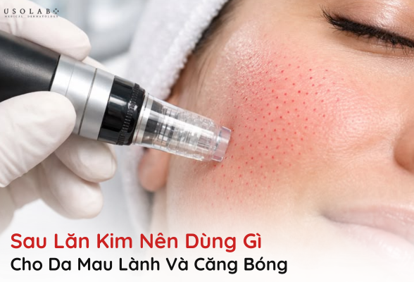 sau lăn kim nên dùng gì