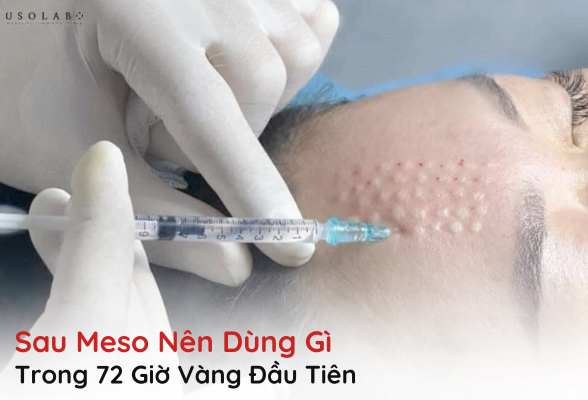 sau meso nên dùng gì