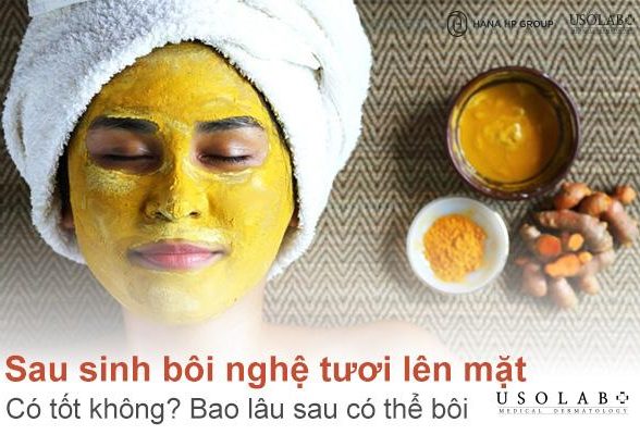 Sau sinh bôi nghệ tươi lên mặt có tốt không? Bao lâu sau có thể bôi