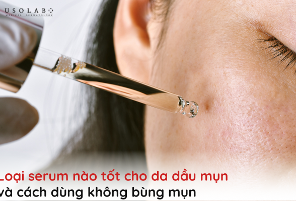loại serum nào tốt cho da dầu mụn