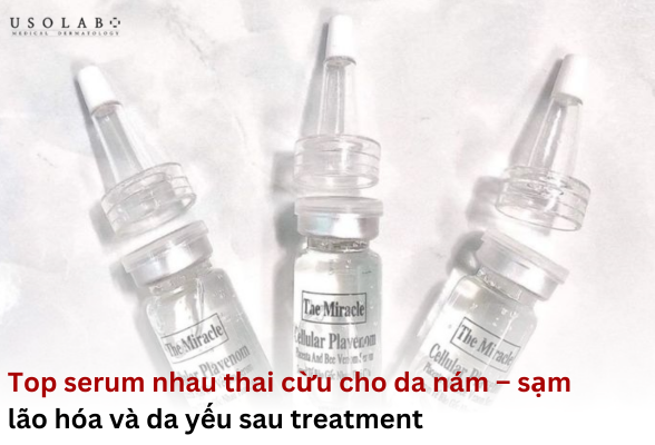 serum nhau thai cừu