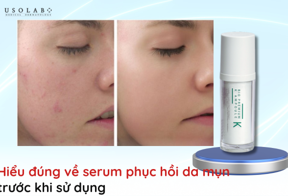 serum phục hồi da mụn