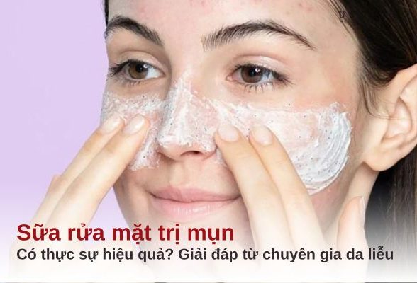sữa rửa mặt trị mụn