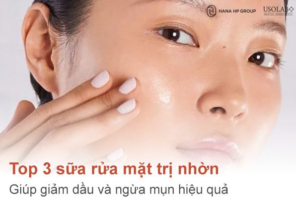 Top 3 sữa rửa mặt trị nhờn giúp giảm dầu và ngừa mụn hiệu quả