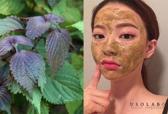 Cách làm mặt nạ lá tía tô trị nám hiệu quả tại nhà