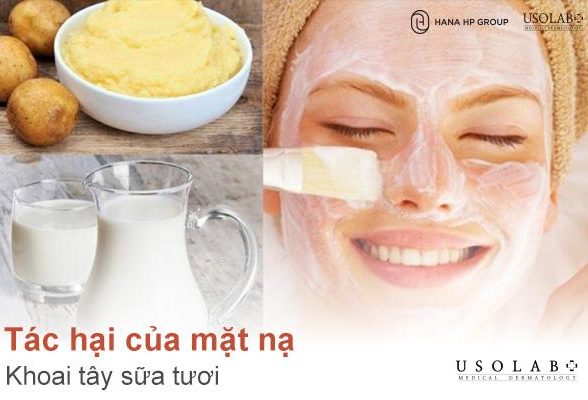 4 Tác hại của mặt nạ khoai tây sữa tươi luôn tiềm ẩn nếu không chú ý