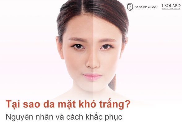 Tại sao da mặt khó trắng? Nguyên nhân và cách khắc phục