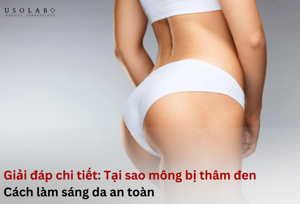 tại sao mông bị thâm đen