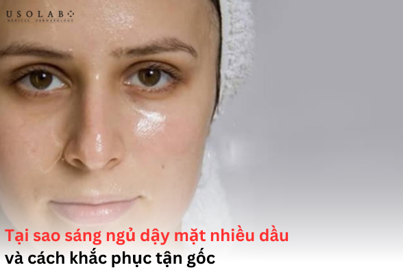 tại sao sáng ngủ dậy mặt nhiều dầu