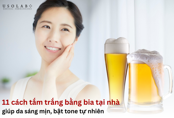 tắm trắng bằng bia