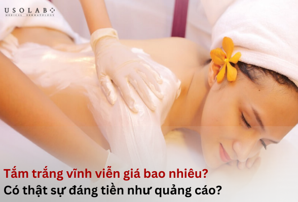 tam-trang-vinh-vien-gia-bao-nhieu tắm trắng vĩnh viễn giá bao nhiêu