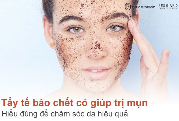 Tẩy tế bào chết có giúp trị mụn không? Hiểu đúng để chăm sóc da hiệu quả
