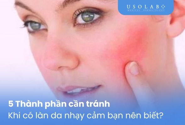 Thành phần cần tránh khi có làn da nhạy cảm