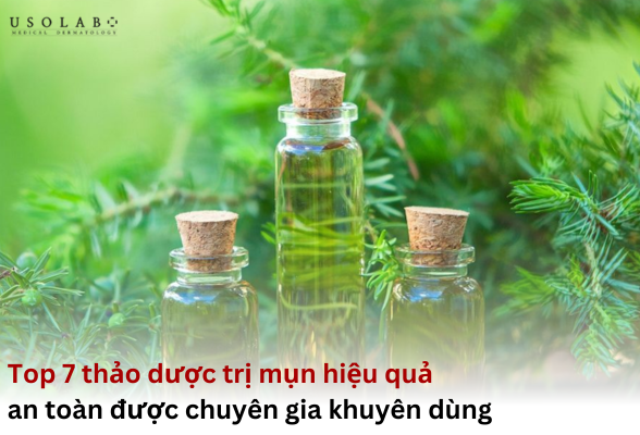 thảo dược trị mụn