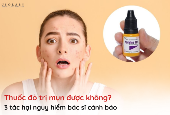 thuốc đỏ có trị mụn được không