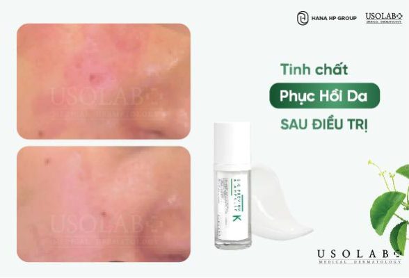 Top 10 tinh chất phục hồi da sau điều trị được mua nhiều nhất 2025