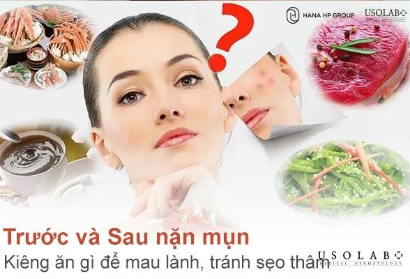 Trước và Sau nặn mụn kiêng ăn gì để mau lành, tránh sẹo thâm? 