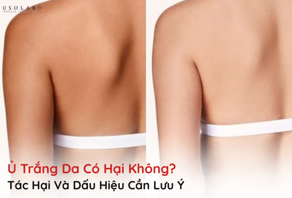 ủ trắng da có hại không