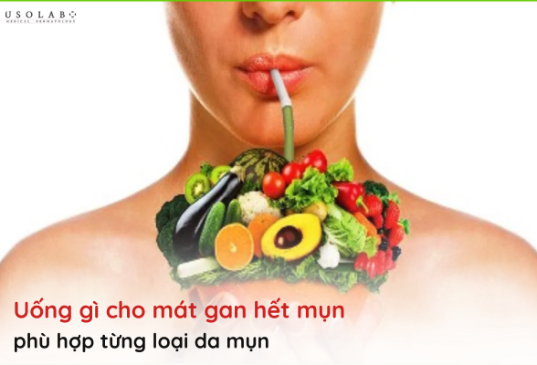 uống gì cho mát gan hết mụn