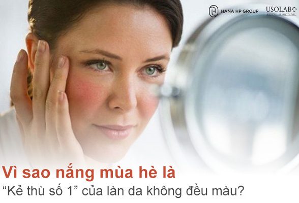 Vì sao nắng mùa hè là “kẻ thù số 1” của làn da không đều màu?