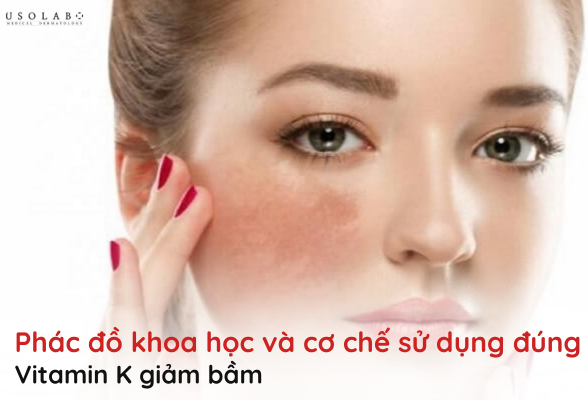 vitamin k giảm bầm