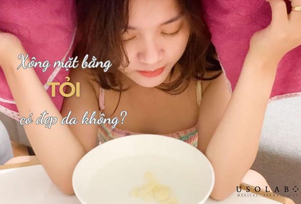 xông mặt bằng tỏi có đẹp da không