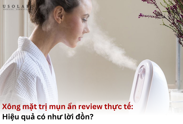 xông mặt trị mụn ẩn review